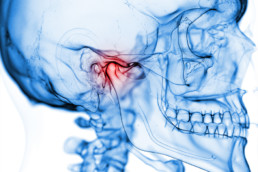 Temporomandibular Joint (TMJ) surgery Brisbane Dr Michael Burgess